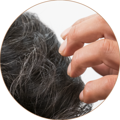枚方市・メンズトータルビューティーサロン| MATRIX(マトリックス)の発毛ケア。特許取得ブラシを使ったMATRIXオリジナルの自信メニュー。頭皮を柔らかくして、血流を蘇らせる。
